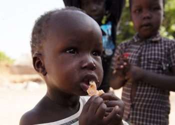 يعاني عشرات الطفال في السودان من سوء تغذية حاد